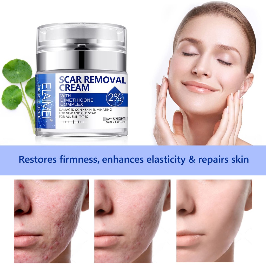 scar-cream-scar-removal-cream-advanced-s-4.jpg