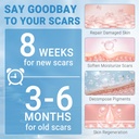 silicone-scar-gel-scar-cream-advanced-sc-5.jpg