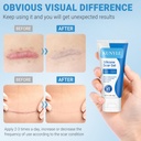 silicone-scar-gel-scar-cream-advanced-sc-3.jpg