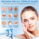 silicone-scar-gel-scar-cream-advanced-sc-4.jpg