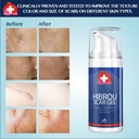 hibrou-advanced-silicone-scar-gel-medica-2.jpg