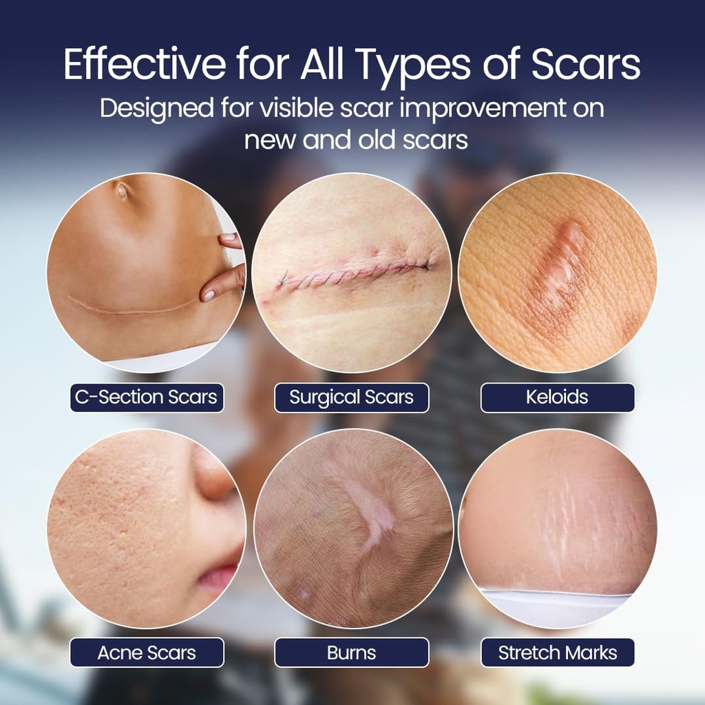 silicone-scar-patches-strips-18-pre-cut--4.jpg