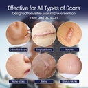 silicone-scar-patches-strips-18-pre-cut--4.jpg
