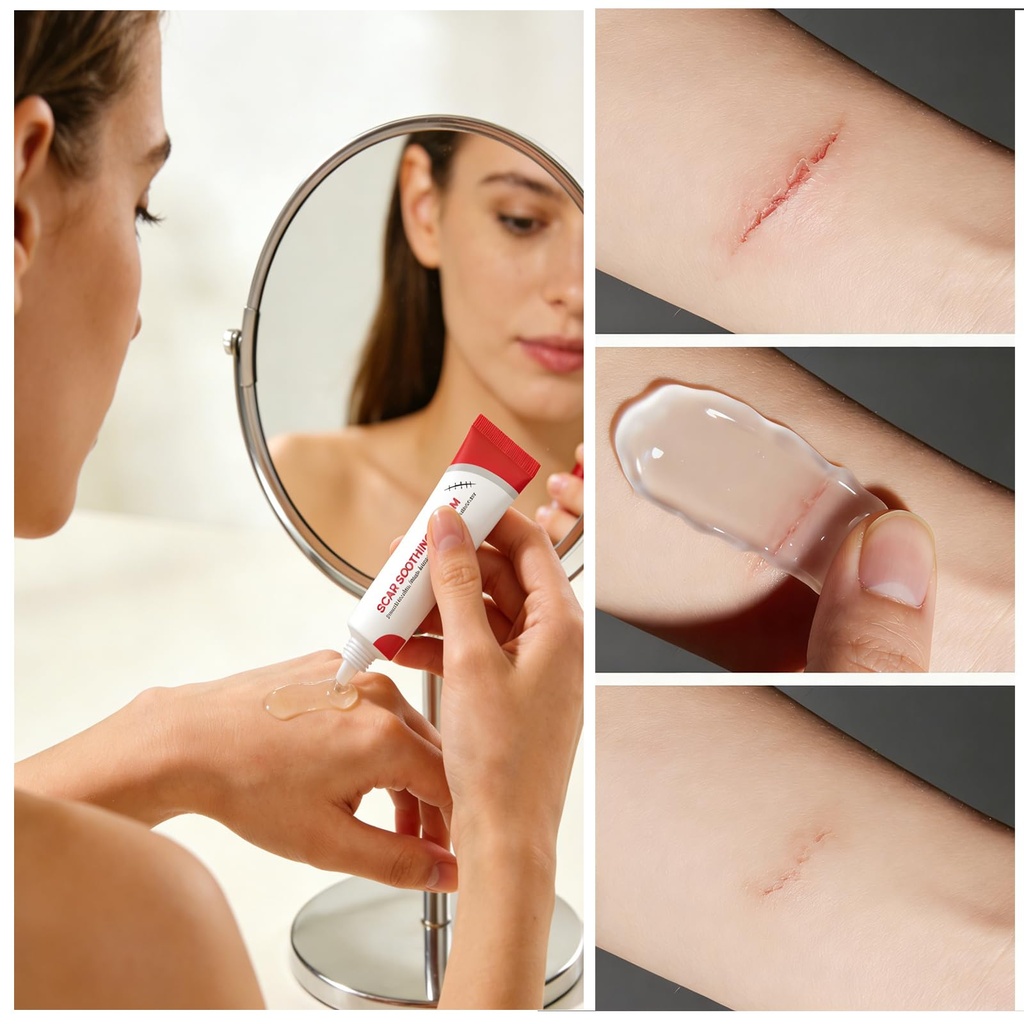 scar-cream-silicone-gel-for-scar-removal-2.jpg