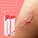 scar-cream-silicone-gel-for-scar-removal-4.jpg