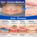 morovan-silicone-scar-removal-gel-scar-c-2.jpg