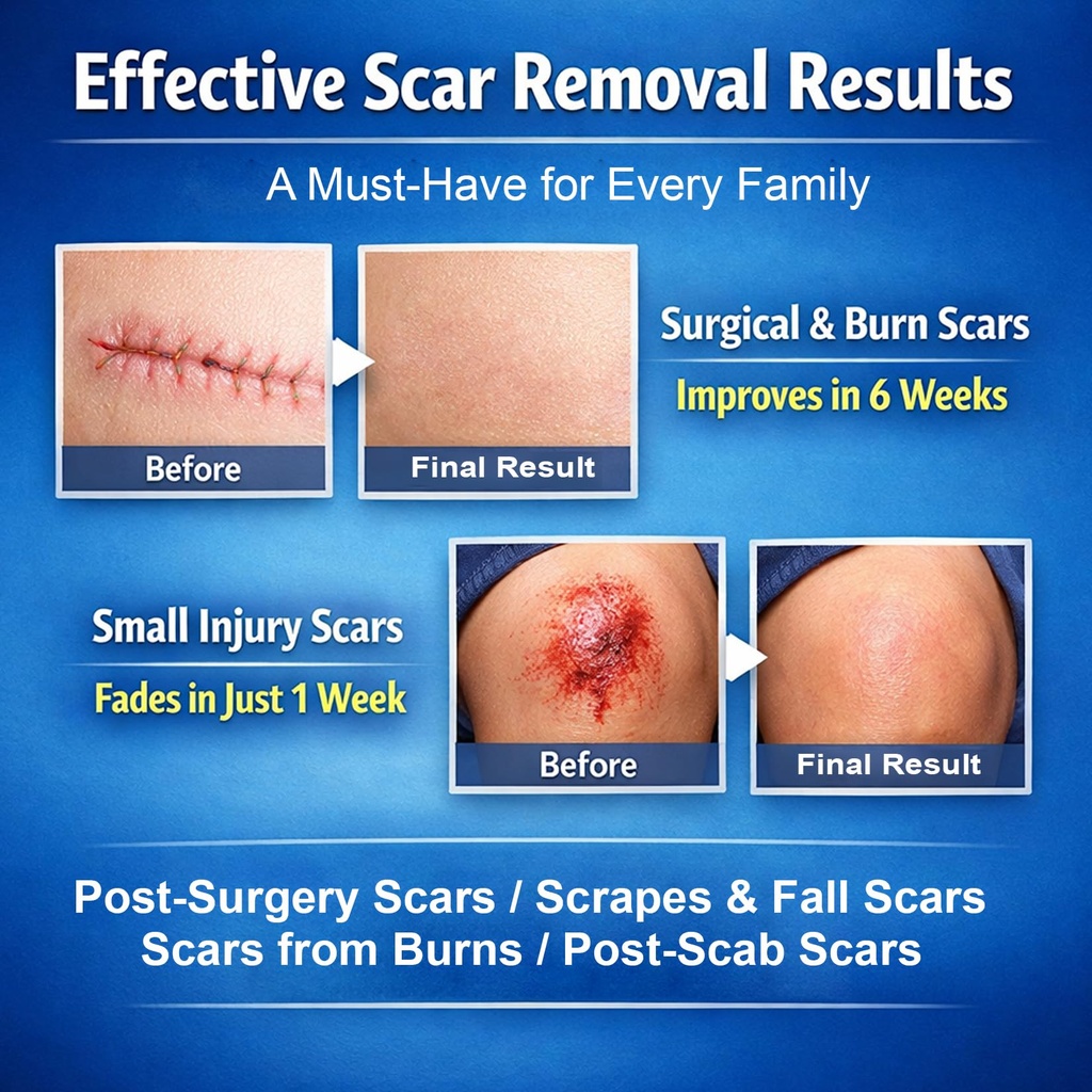 morovan-silicone-scar-removal-gel-scar-c-3.jpg