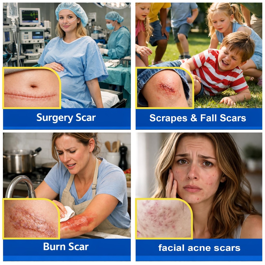 morovan-silicone-scar-removal-gel-scar-c-4.jpg