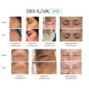 skinuva-scar-cream-for-face-body-old-new-6.jpg