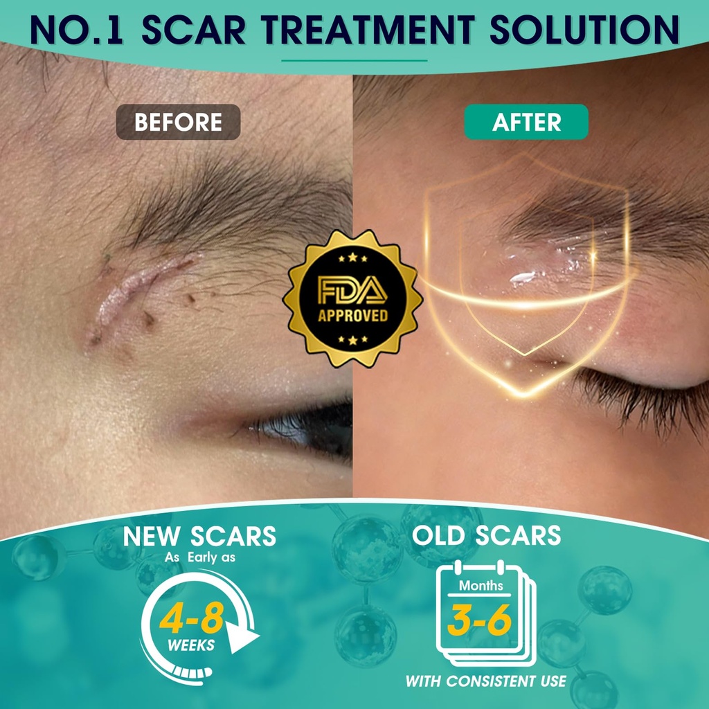 scarmd-silicone-scar-gel-100-pure-scar-c-4.jpg