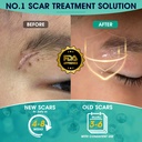 scarmd-silicone-scar-gel-100-pure-scar-c-4.jpg