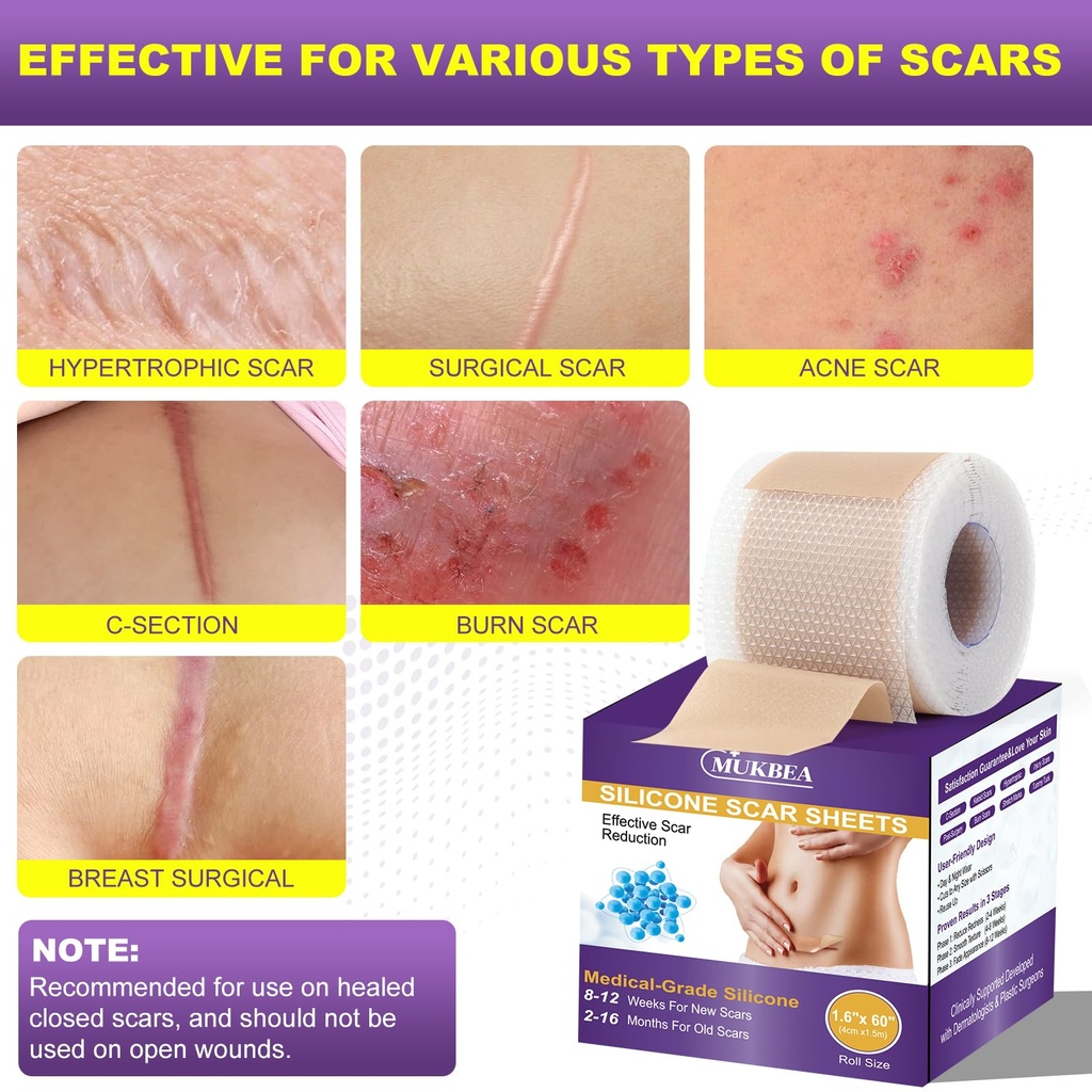 silicone-scar-sheets-silicone-scar-tape--2.jpg