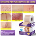 silicone-scar-sheets-silicone-scar-tape--2.jpg