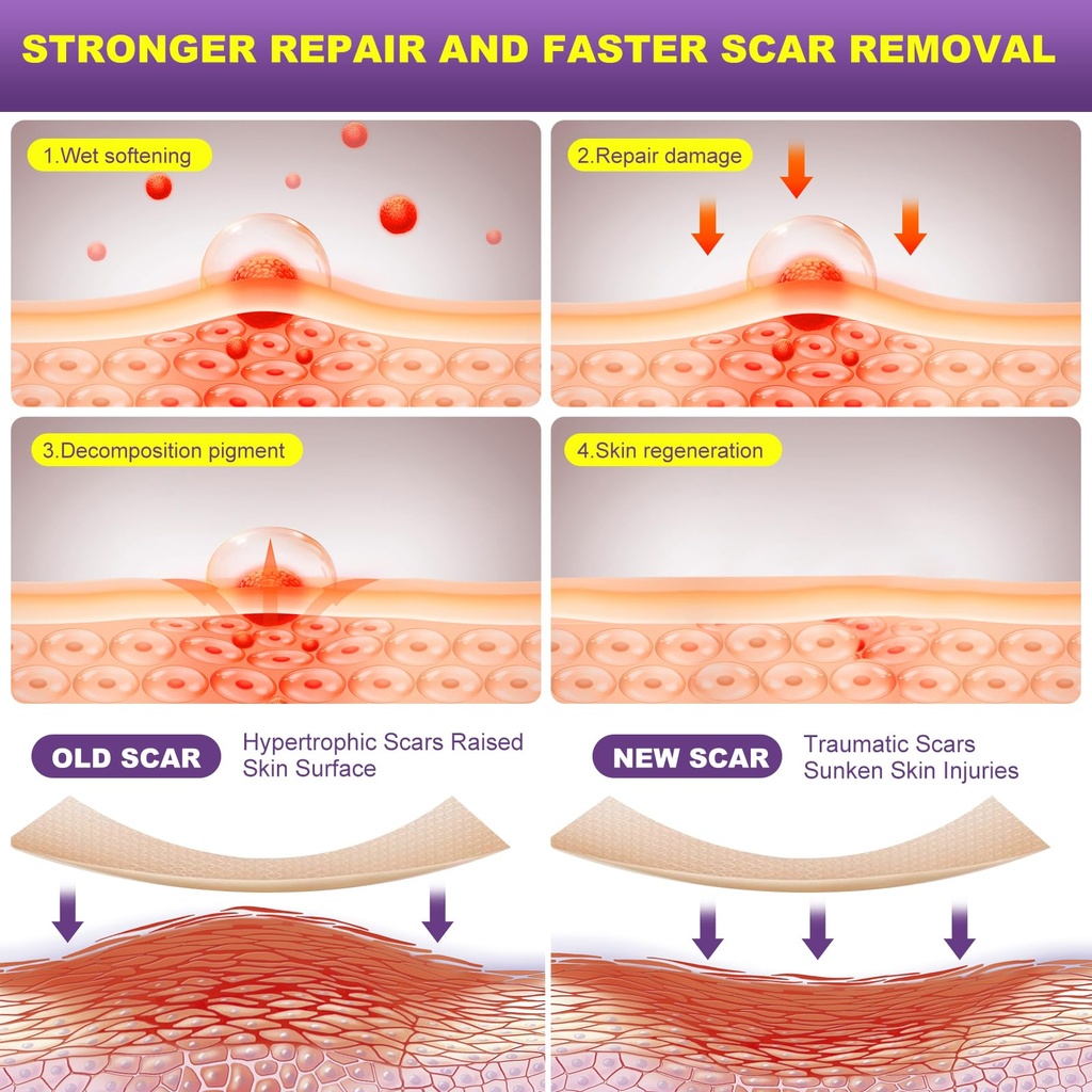 silicone-scar-sheets-silicone-scar-tape--3.jpg