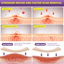 silicone-scar-sheets-silicone-scar-tape--3.jpg