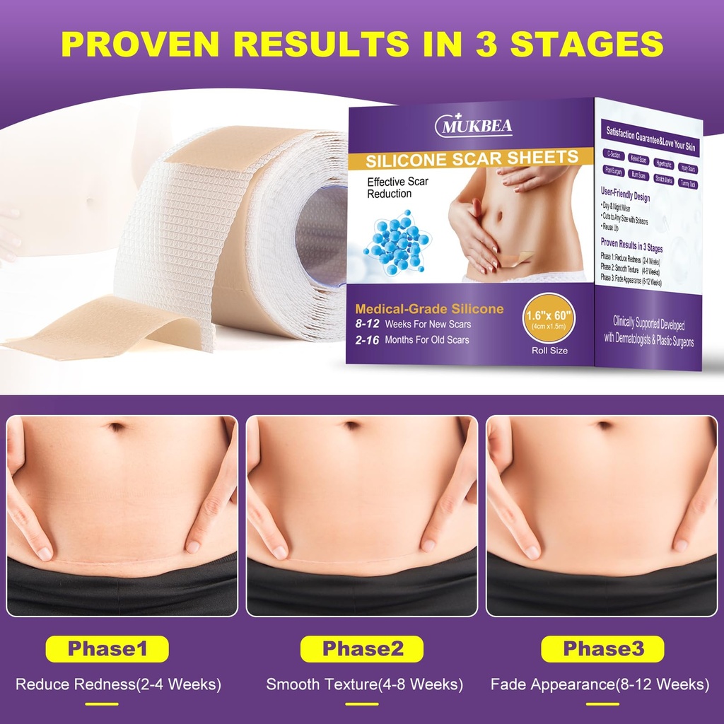 silicone-scar-sheets-silicone-scar-tape--6.jpg