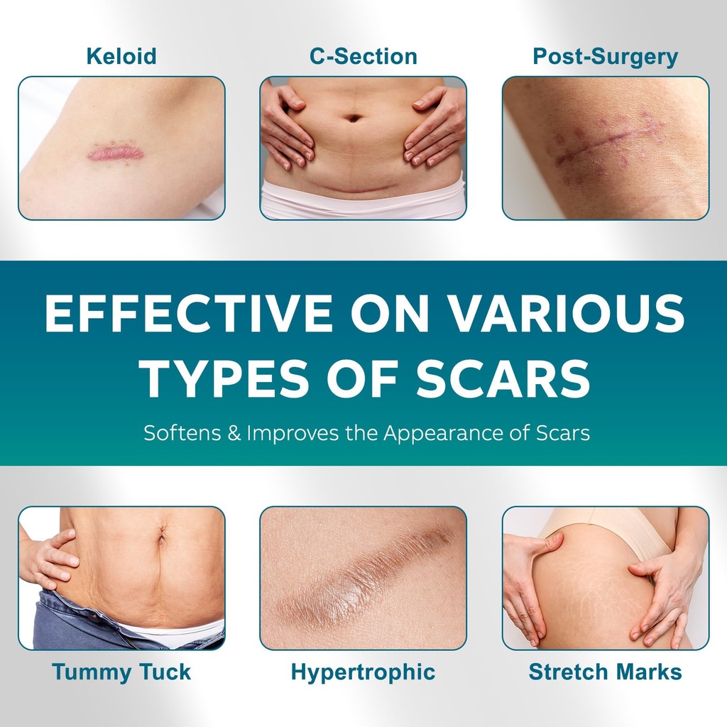 scar-gel-scar-cream-advanced-scar-gel-fo-3.jpg
