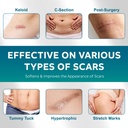 scar-gel-scar-cream-advanced-scar-gel-fo-3.jpg