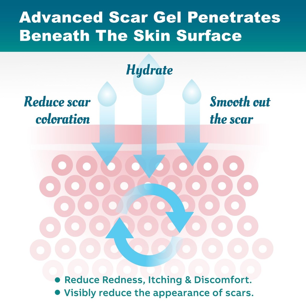 scar-gel-scar-cream-advanced-scar-gel-fo-4.jpg