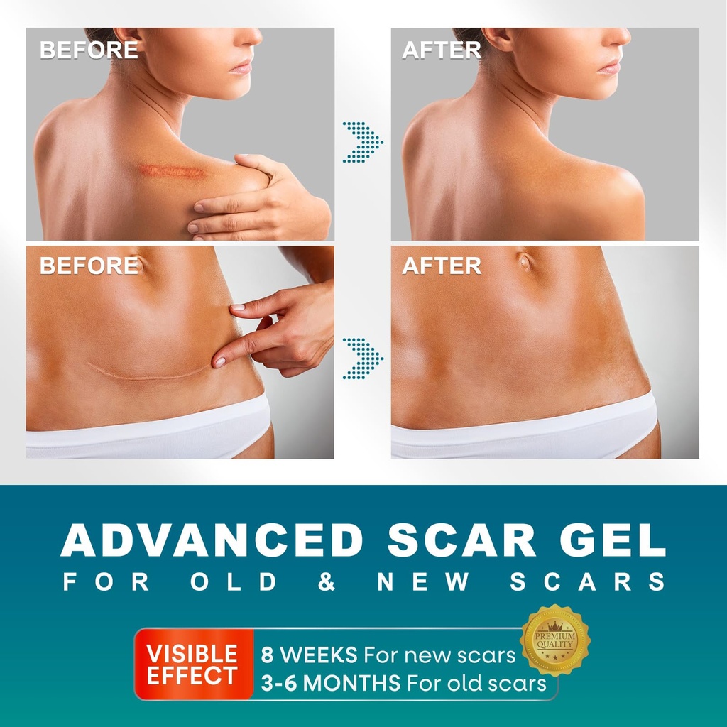 scar-gel-scar-cream-advanced-scar-gel-fo-2.jpg