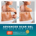 scar-gel-scar-cream-advanced-scar-gel-fo-2.jpg