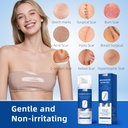 silicone-scar-gel-for-old-and-new-scars--2.jpg