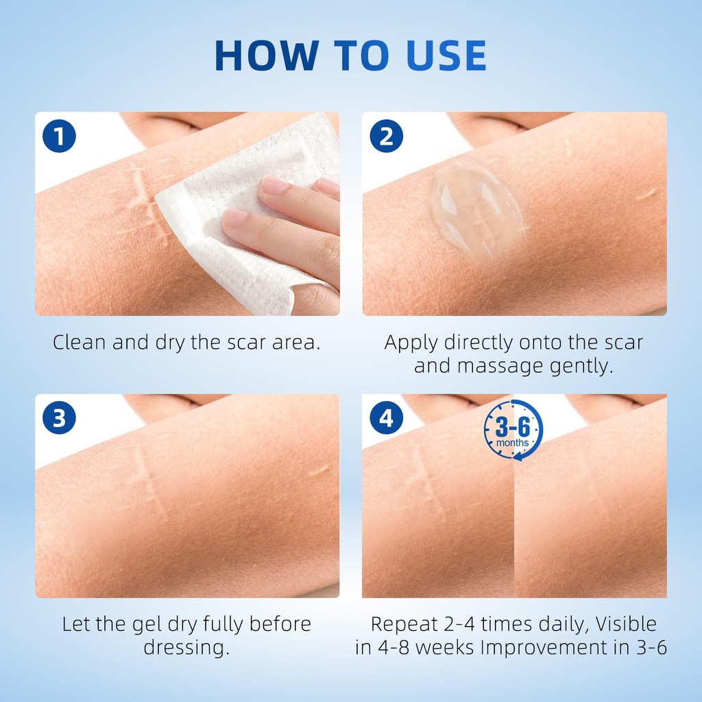 silicone-scar-gel-for-old-and-new-scars--5.jpg