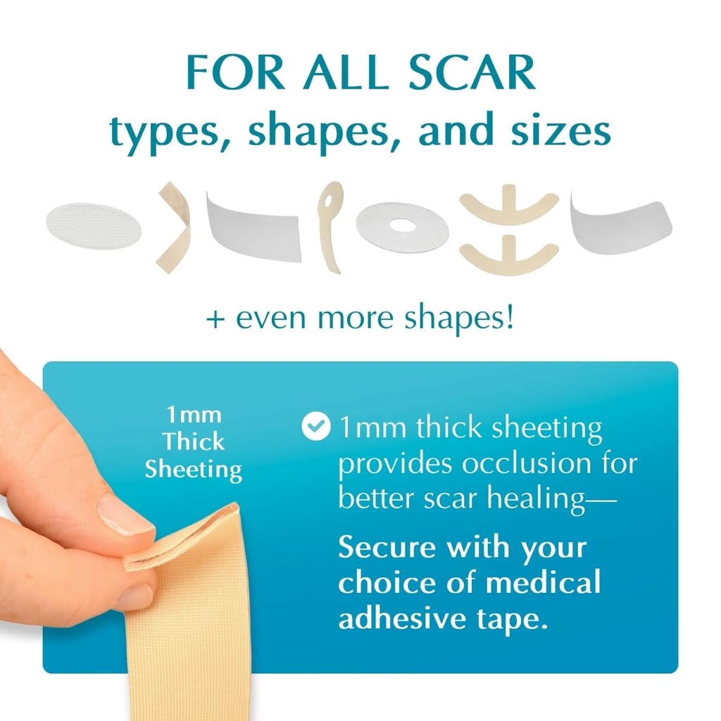 mynewgel-advanced-silicone-scar-treatmen-6.jpg