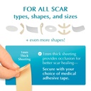 mynewgel-advanced-silicone-scar-treatmen-6.jpg