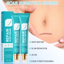 2pcs-scar-cream-for-men-and-women-scar-r-4.jpg