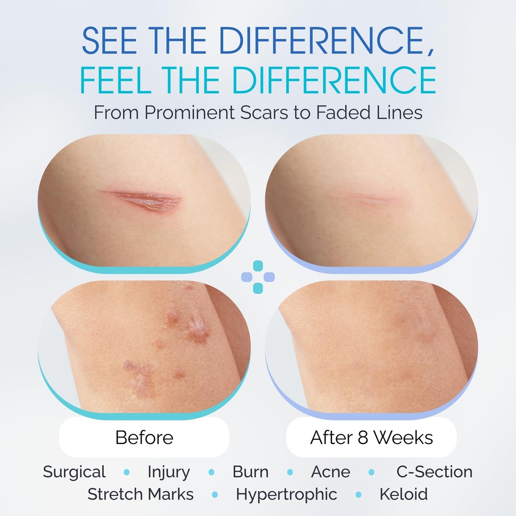 silicone-scar-gel-with-scar-smoothing-tr-2.jpg