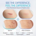 silicone-scar-gel-with-scar-smoothing-tr-2.jpg