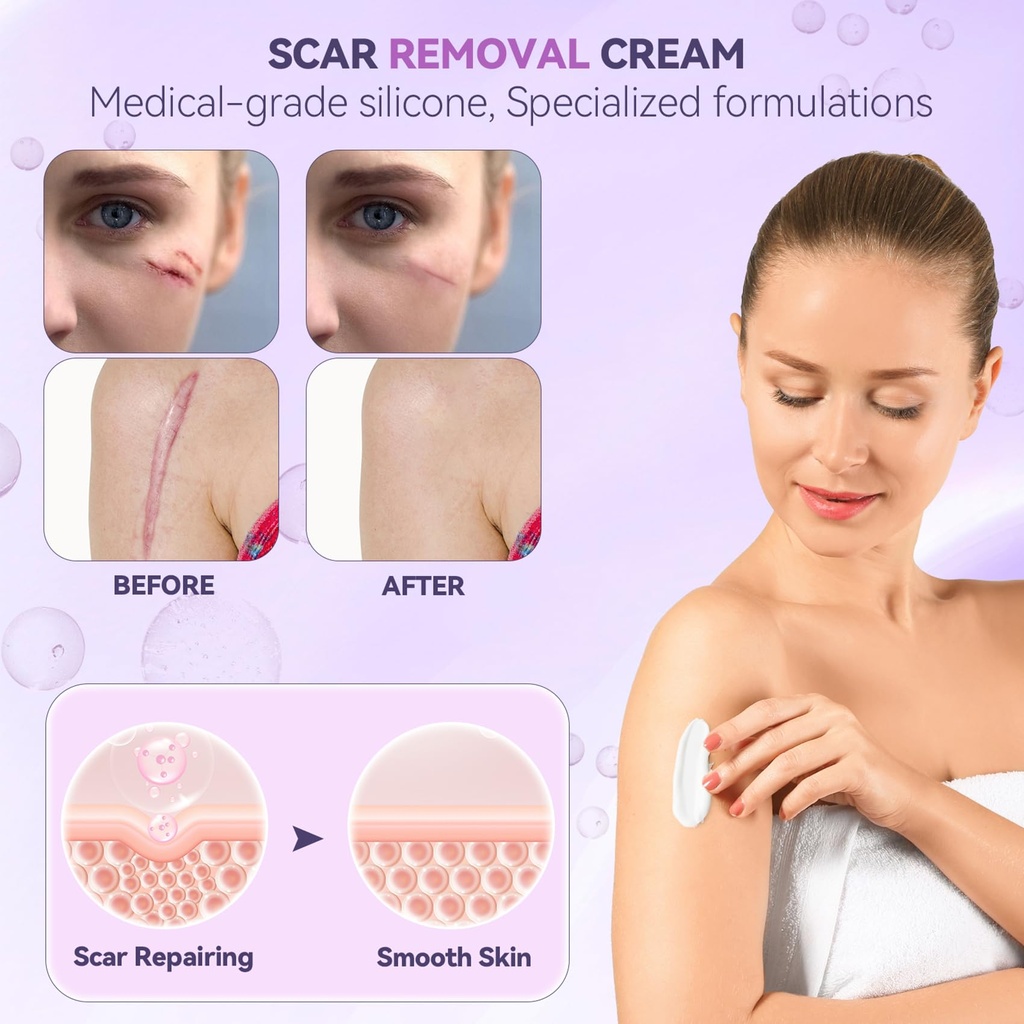 advanced-scar-cream-silicone-scar-gel-fo-3.jpg