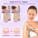 advanced-scar-cream-silicone-scar-gel-fo-3.jpg