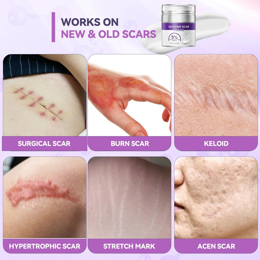 advanced-scar-cream-silicone-scar-gel-fo-5.jpg
