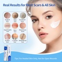 silicone-scar-gel-for-old-new-scars-adva-2.jpg
