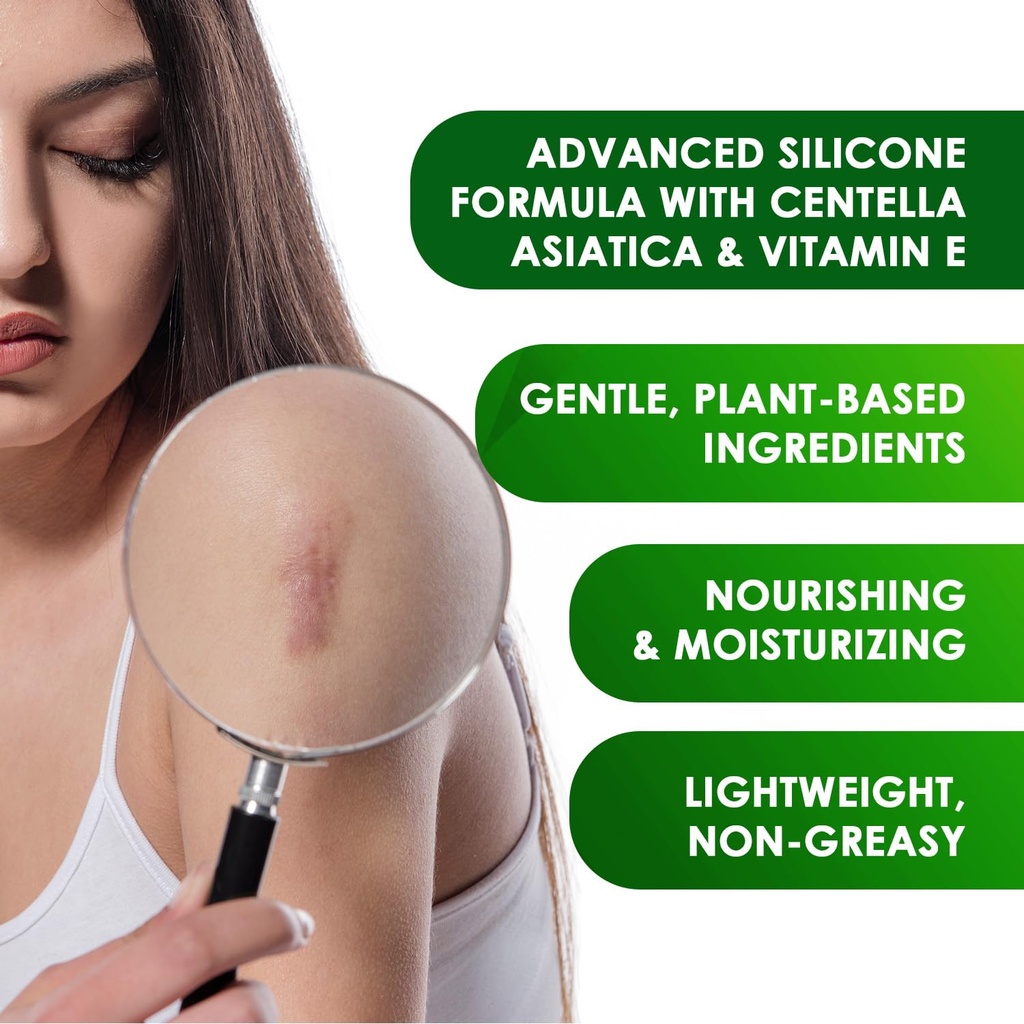 tobcharm-advanced-keloid-scar-care-gel-s-3.jpg