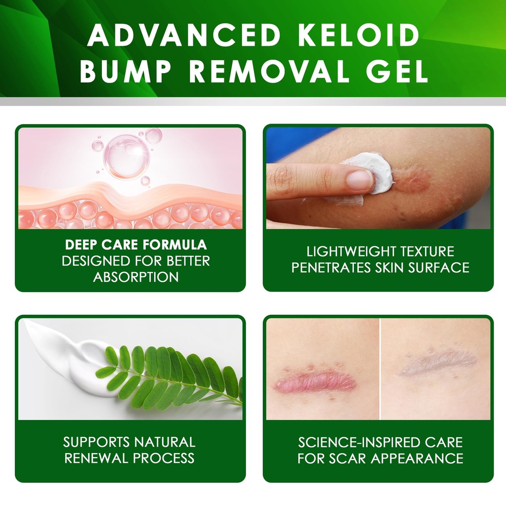 tobcharm-advanced-keloid-scar-care-gel-s-4.jpg