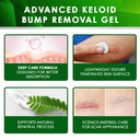 tobcharm-advanced-keloid-scar-care-gel-s-4.jpg