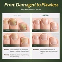 toenail-fungus-treatment-extra-strength--4.jpg