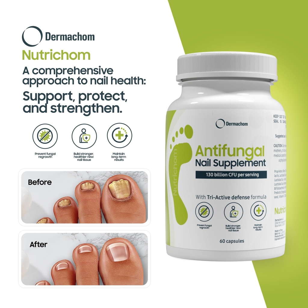 nutrichom-probiotic-fungal-nail-cleaner--4.jpg