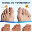 villsure-toenail-fungus-pen-toenail-fung-4.jpg