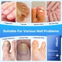 villsure-toenail-fungus-pen-toenail-fung-5.jpg