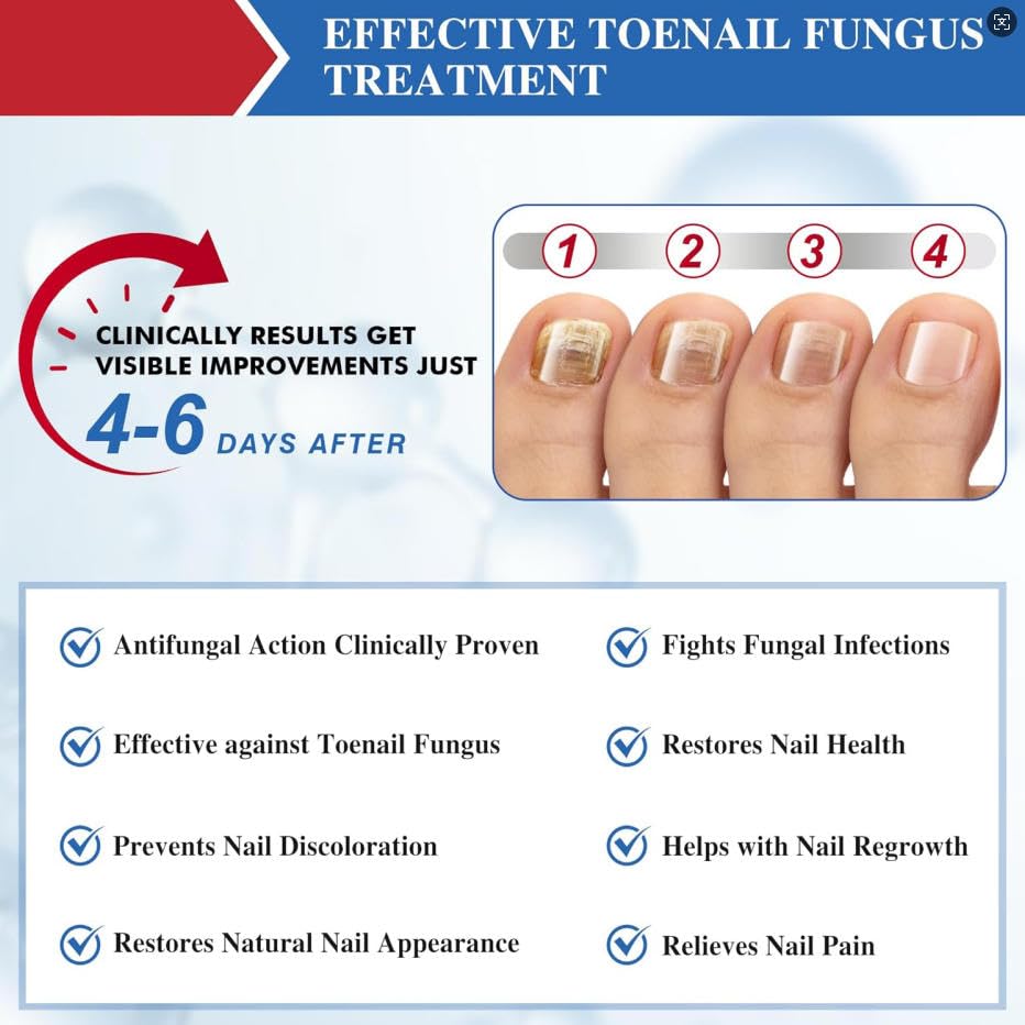 toenail-fungus-treatment-extra-strength--6.jpg