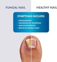 laser-spray-antifungal-treatment-3-oz-a--4.jpg