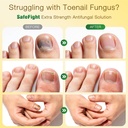 toenail-fungus-treatment-with-25-undecyl-5.jpg