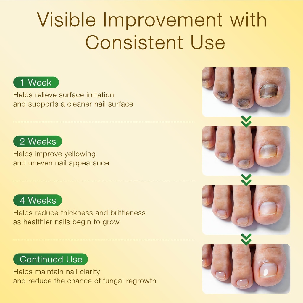 toenail-fungus-treatment-with-25-undecyl-6.jpg