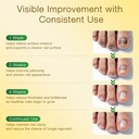 toenail-fungus-treatment-with-25-undecyl-6.jpg