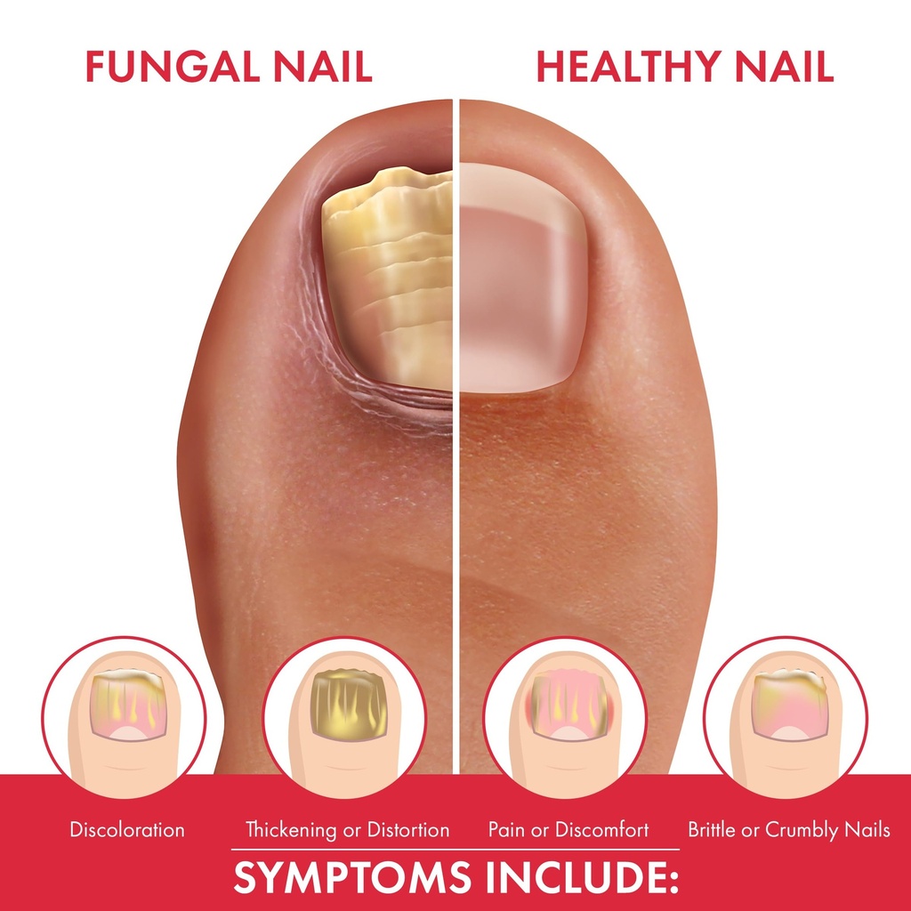 fungal-shield-professional-antifungal-tr-6.jpg