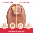 fungal-shield-professional-antifungal-tr-6.jpg